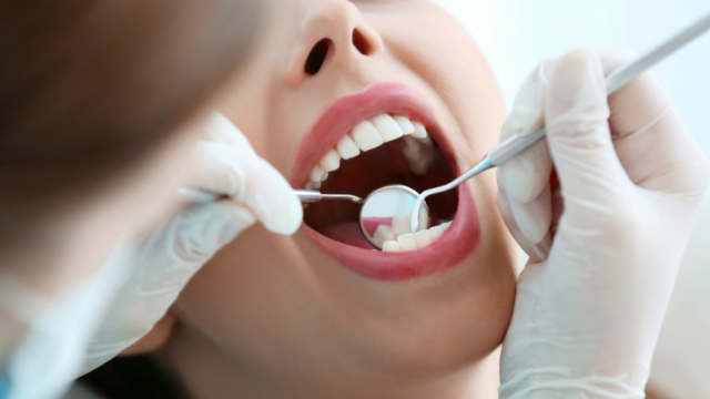 Cara Menjaga Kesehatan Gigi dan Gusi yang Benar Menurut Pakar Kesehatan!